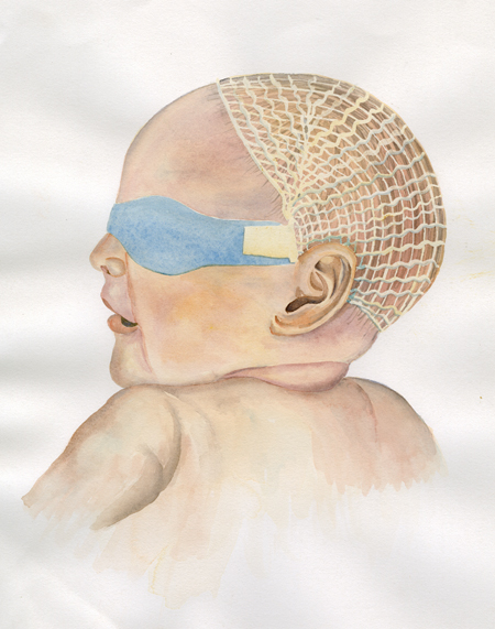 A watercolor sketch of a baby’s head and shoulders in profile. The baby is wearing a mask over its eyes to protect it during phototherapy treatments for jaundice. The mask is secured with a stretchy net cap of gauze that fits over the baby’s head.
